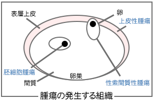 腫瘍の発生する組織